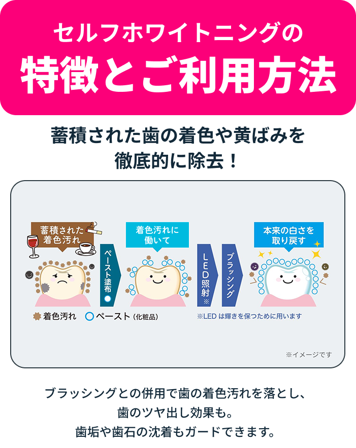 セルフホワイトニングの特徴とご利用方法