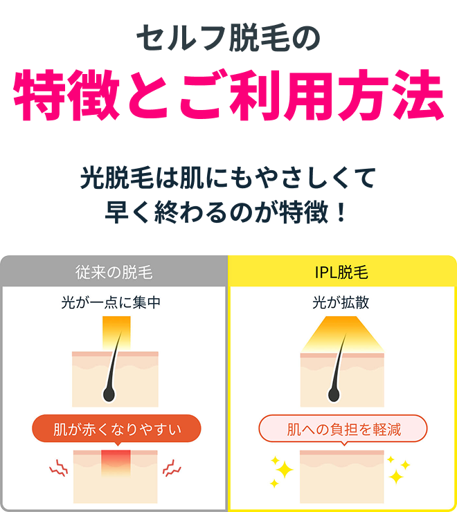 セルフ脱毛の特徴とご利用方法
