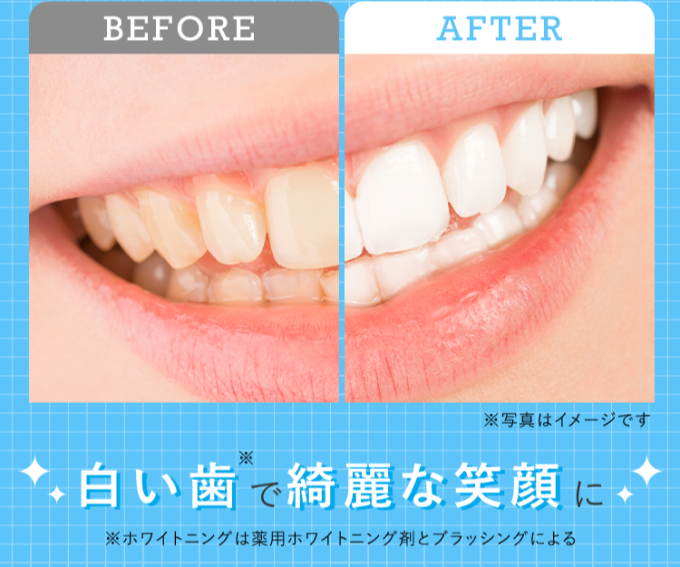 白い歯で綺麗な笑顔に