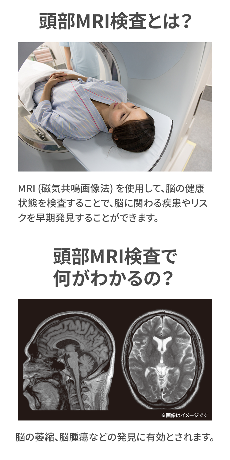 頭部MRI検査とは？