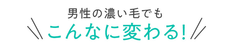 男性の濃い毛でもこんなに変わる!