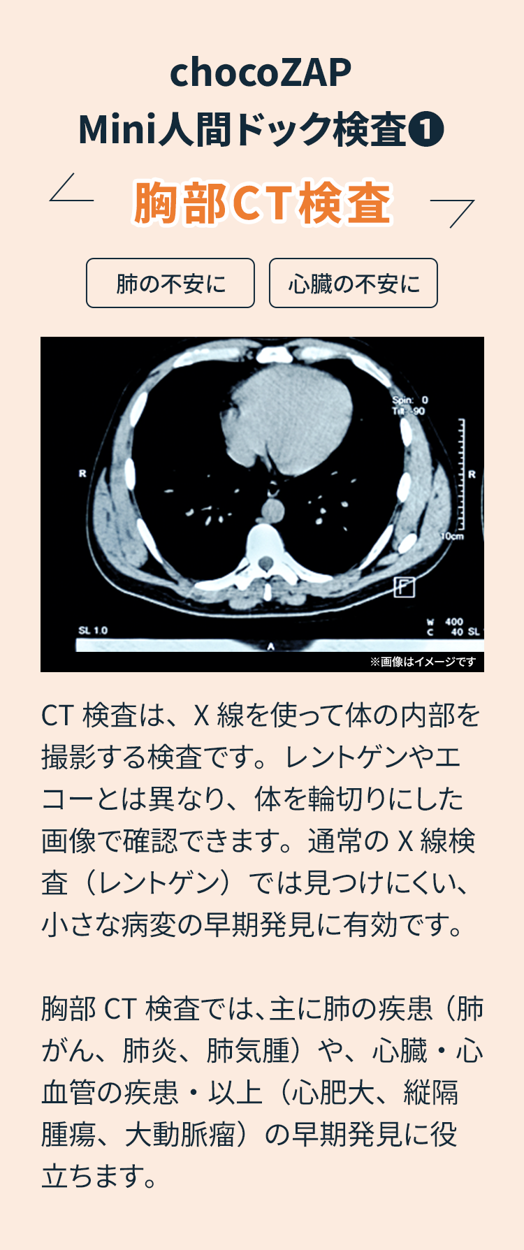 chocoZAP Mini人間ドック検査① 胸部CT検査