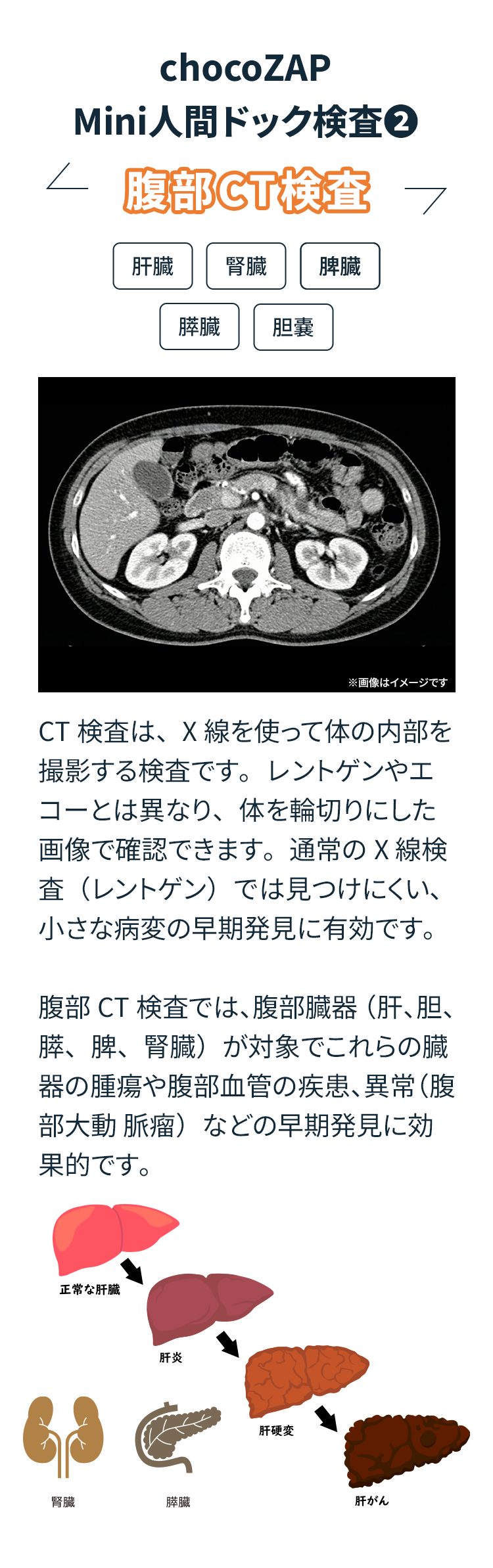 chocoZAP Mini人間ドック検査② 腹部CT検査