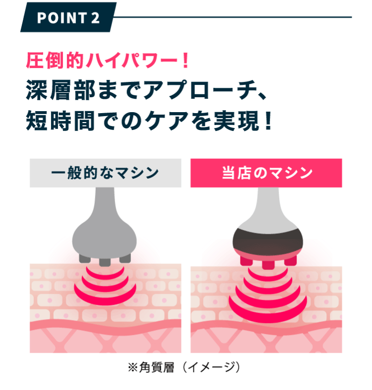 POINT2