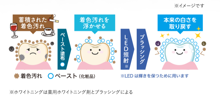 ホワイトニングのイメージ
