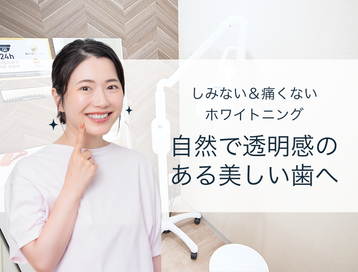 セルフホワイトニング